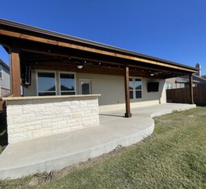 Custom patio covers North Texas